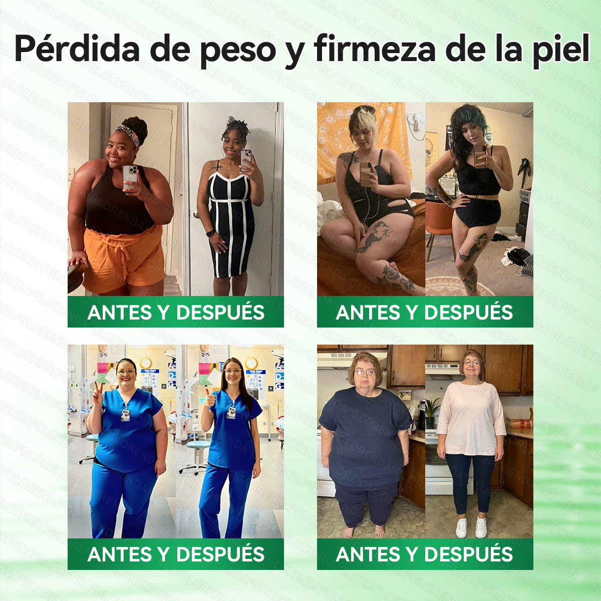 🇺🇲𝑻𝒊𝒆𝒏𝒅𝒂 𝑶𝒇𝒊𝒄𝒊𝒂𝒍 | 💃💃𝑮𝑳𝑶𝑹𝑬𝐍𝐃𝗔®𝗠𝗼𝗿𝙞𝙣𝙜𝙖 · 𝘽𝙚𝙧𝙗𝙚𝙧𝙞𝙣𝒂 × 𝑵𝑨𝐃+ 𝐏𝐚𝐫𝐜𝙝𝙚 𝘼𝙫𝙖𝙣𝙯𝙖𝙙𝗼 𝗱𝗲 𝗠𝗶𝗰𝗿𝗼𝒏𝒂𝒍𝒈𝒂 𝑵𝒂𝐧𝐨 𝟏0-𝙚𝙣-1(𝐒𝐨𝐥𝐨 𝐮𝐧𝐚 𝐯𝐞𝐳 𝐚𝐥 𝐝í𝐚） ✅ 𝐏𝐚𝐫𝐚 𝐥𝐚 𝐨𝐛𝐞𝐬𝐢𝐝𝐚𝐝, 🅟🅘🅔🅛 🅕🅛🅐🅒🅘🅓🅐, 𝐝𝐢𝐚𝐛𝐞𝐭𝐞𝐬, 𝐚𝐩𝐧𝐞𝐚 𝐝𝐞𝐥 𝐬𝐮𝐞ñ𝐨, 𝐩𝐫𝐨𝐛𝐥𝐞𝐦𝐚𝐬 𝐚𝐫𝐭𝐢𝐜𝐮𝐥𝐚𝐫𝐞𝐬, 𝐲 𝐦𝐮𝐜𝐡𝐨 𝐦á𝐬