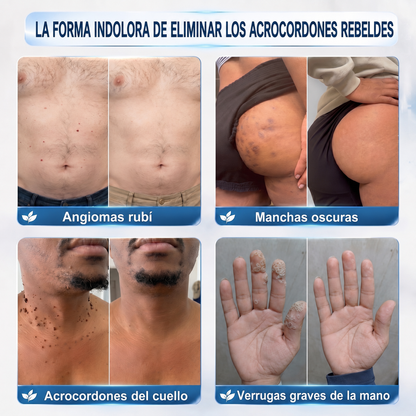 Recomendado por farmacéuticos 👑🍇 𝑯𝗲𝙖𝐥𝒓𝗶𝙯𝗲® Borrador de Manchas y Pecas de 7 Días 🪄 (Roller sin dolor, sin dejar marcas) 👩‍⚕️
