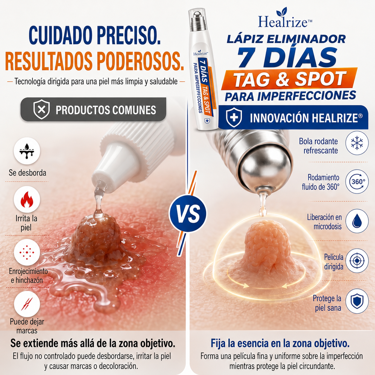 Recomendado por farmacéuticos 👑🍇 𝑯𝗲𝙖𝐥𝒓𝗶𝙯𝗲® Borrador de Manchas y Pecas de 7 Días 🪄 (Roller sin dolor, sin dejar marcas) 👩‍⚕️
