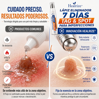 Recomendado por farmacéuticos 👑🍇 𝑯𝗲𝙖𝐥𝒓𝗶𝙯𝗲® Borrador de Manchas y Pecas de 7 Días 🪄 (Roller sin dolor, sin dejar marcas) 👩‍⚕️