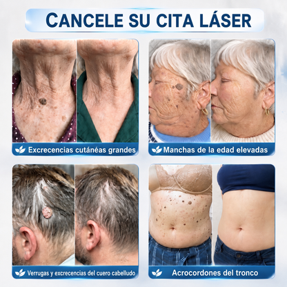 Recomendado por farmacéuticos 👑🍇 𝑯𝗲𝙖𝐥𝒓𝗶𝙯𝗲® Borrador de Manchas y Pecas de 7 Días 🪄 (Roller sin dolor, sin dejar marcas) 👩‍⚕️